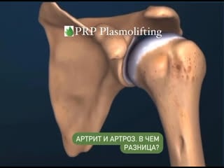 Video by plasmolifting clinic | плазмотерапия | москва