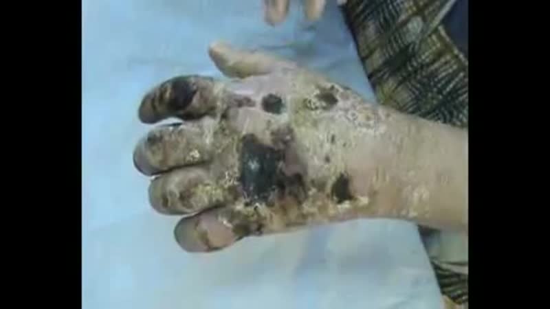 Ужас! жесть гниющие наркоманы! а всё начиналось с пиа и слабо алкоголки