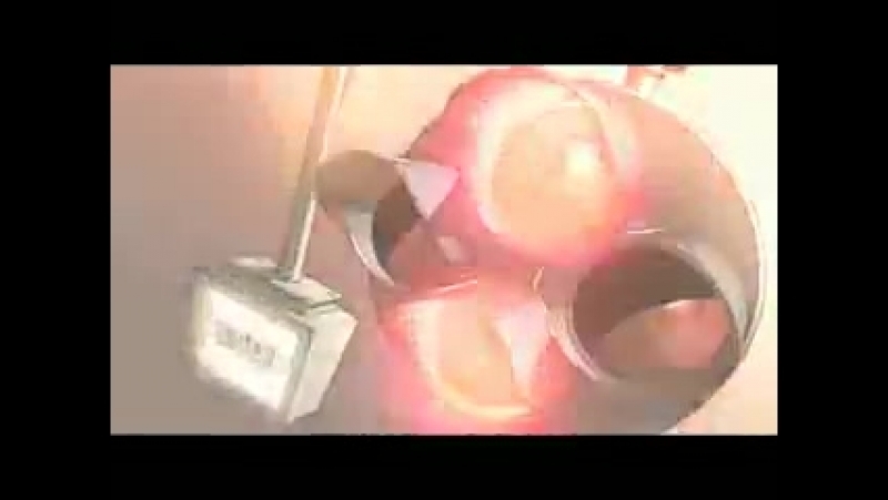 Amvnews upbeat party 2009