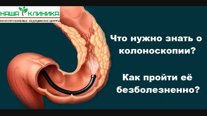 Видео колоноскопия как пройти обследование безболезненно?