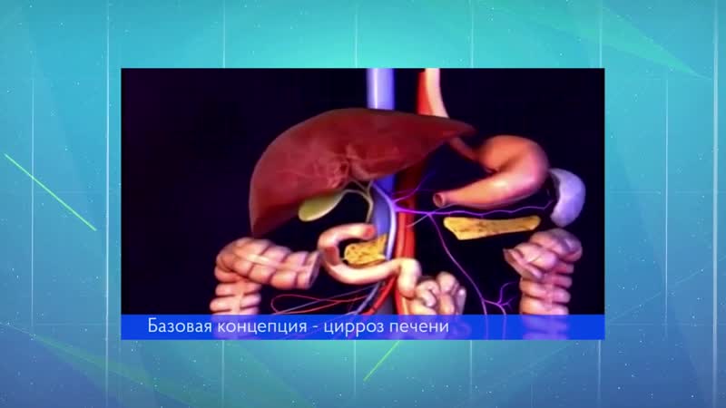 #цирроз#фиброгенез#хронический гепатит