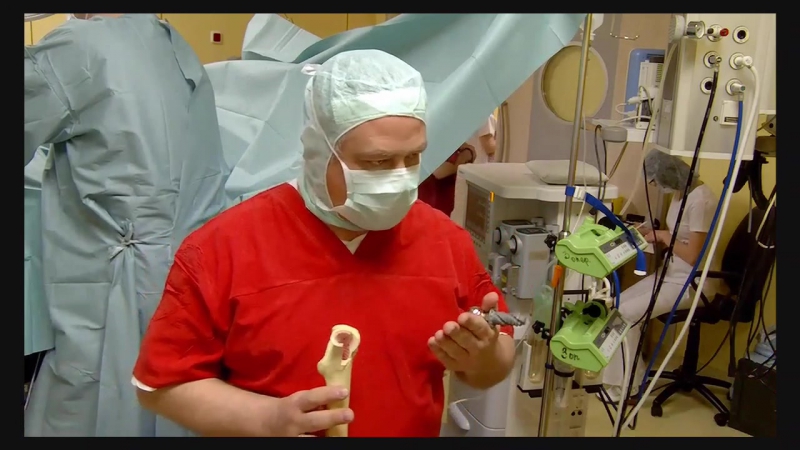 Эндопротезирование правого тазобедренного сустава эндопротезом spiron