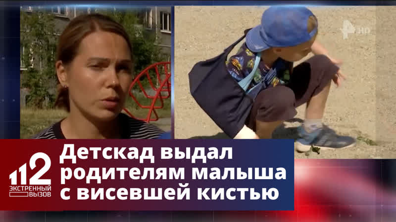 "скажите, что упал дома" детсад выдал маме малыша с "висевшей кистью"