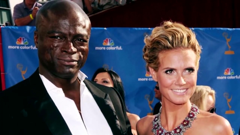 10 дефектов голливудских звезд