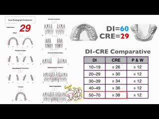 Skeletal anterior open bite with mandibular first molars missing (live) ортодонтия