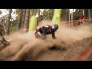 Downhill mtb injury risks are real pain vs reward e1