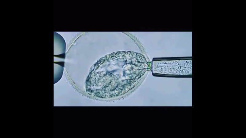 Биопсия эмбриона на 3 день развития для пгд (преимплантационная генетическая диагностика)