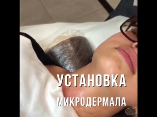 Устаноа микродермала