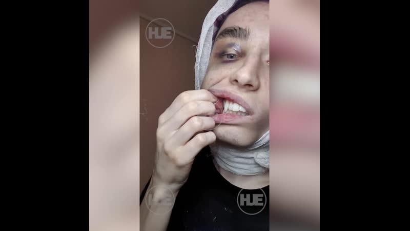 Молодого стилиста в подмосковье избили и порезали за фиолетовые волосы