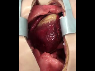 Медицинские достижения, которые приближают нас к реальности