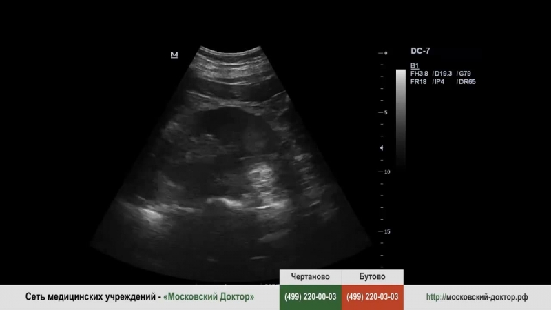 Узи органов мошонки