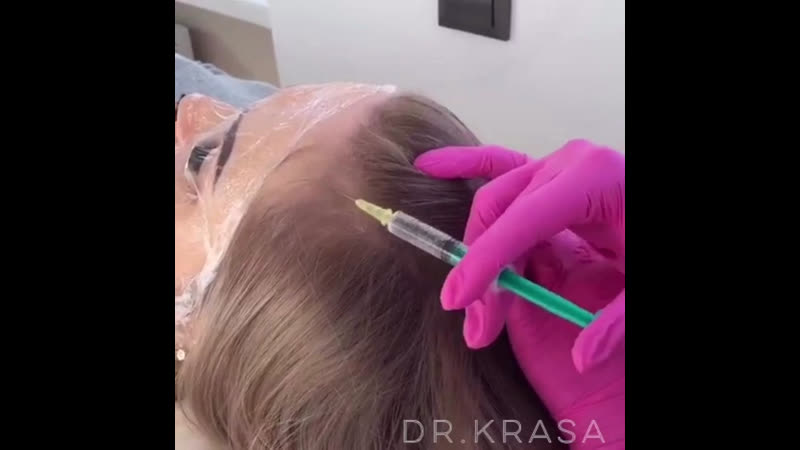 Мезотерапия волос