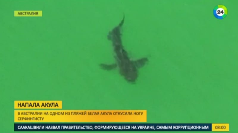 Акула откусила ногу молодому австралийцу