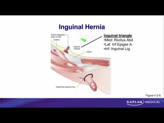 25 anatomy sec ii abdomen, pelvis, and perineum inguinal hernia