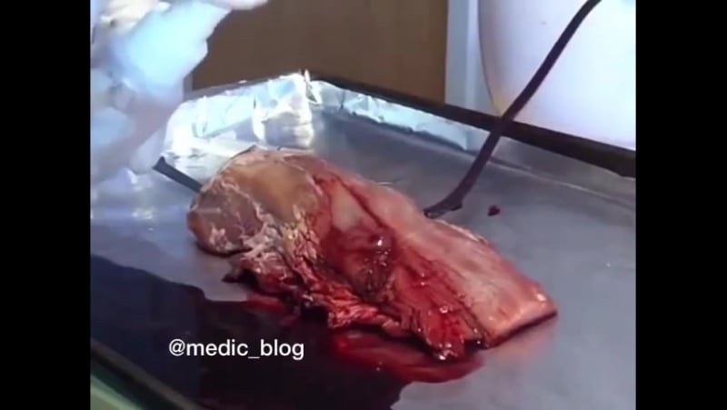 Гель который моментально останавливает кровотечение