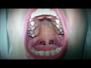 Helena moeller mouth fetish vore