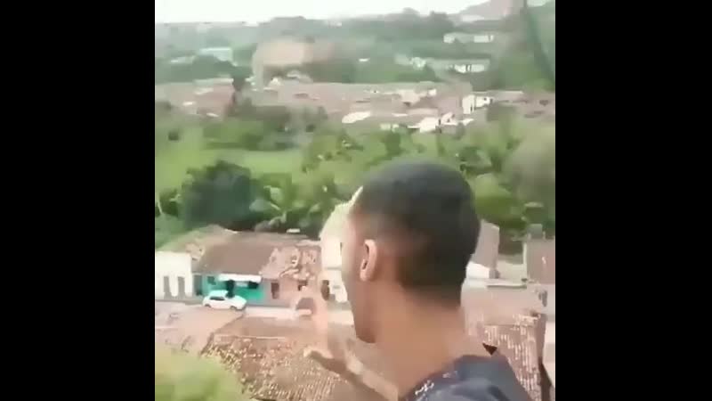 Голливудская улыбка