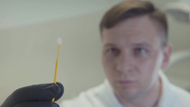 Керамические виниры