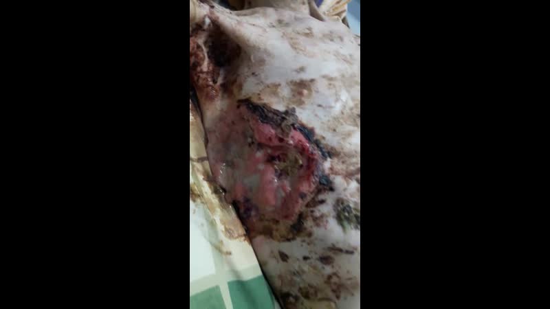 Alexander (orang yahudi) yg sudah meninggal 2 tahun, pada makamnya terdengar suara berteriak,menjerit dan merintih seakan seper