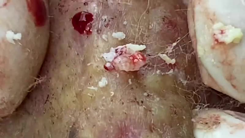 Все виды прыщей на одном лице очень жестко!