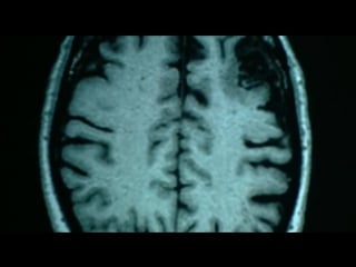 Bbc тайны мозга 4 я серия первый среди равных (brain story)