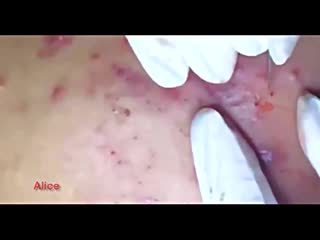 Жирные черные точки