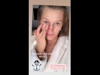 Instagram stories toni garrn