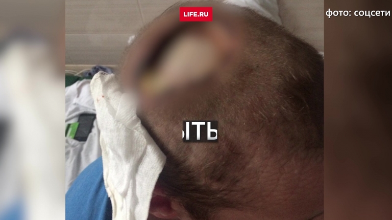 Ударило током, когда спасал молодые