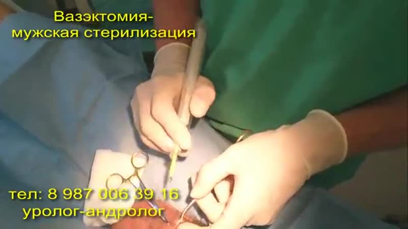 Вазэктомия, мужская стерилизация, контрацепция