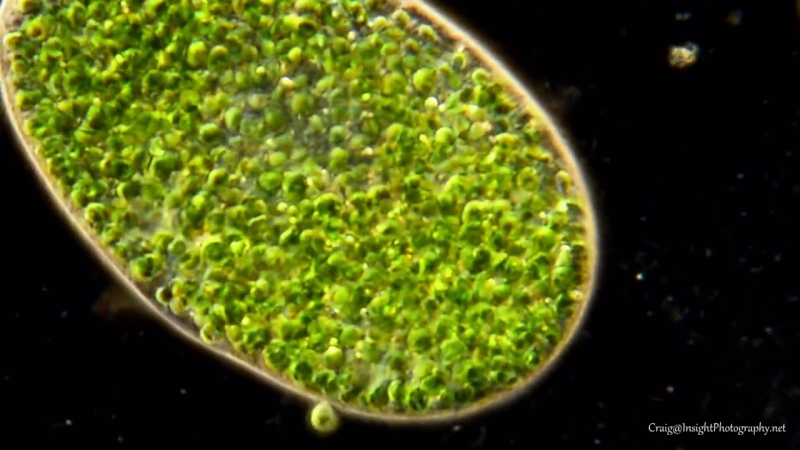 Bursaria porn video – Paramecium bursaria 40x 600x darkfield, ploarized light
