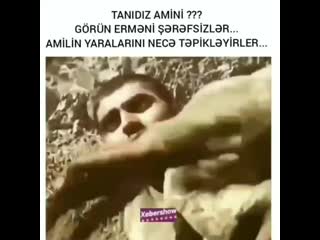 Bizimlə qalın s instagram video tanidiz ami̇ni̇ görün erməni̇ şərəfsi̇zlər ami̇ni̇ yaraladıqdan sonra yaralarini necə