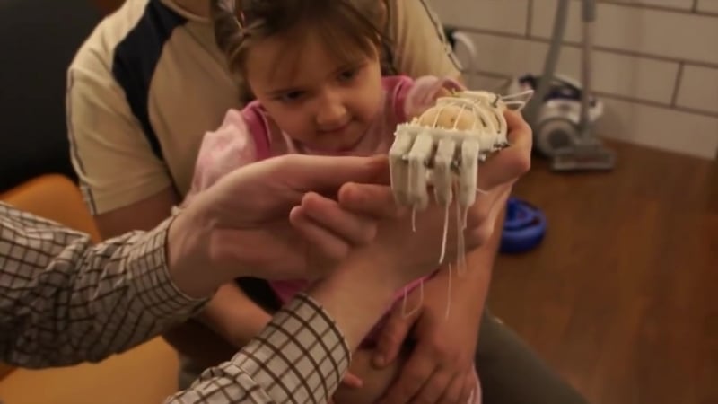 Конкурсное видео компании "моторика" о проекте "функциональное протезирование"