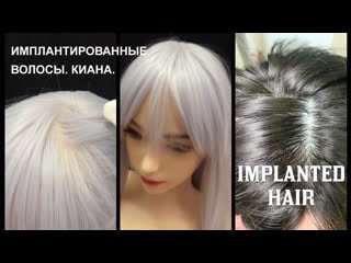 Киана имплантированные волосы