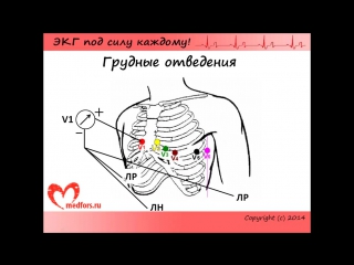 [3 экг под силу каждому] алгоритм анализа экг