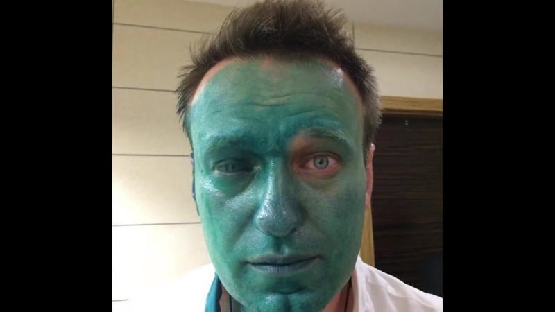 Навального облили зелёнкой (vhs video)