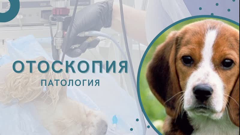 Отоскопия холестеатома уха у молодые