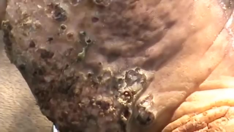 Песчаные блохи под кожей