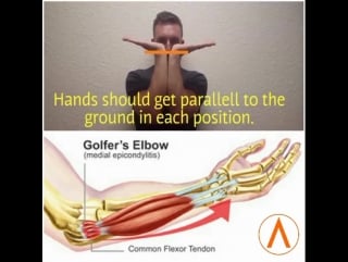 The most common cause of medial elbow pain