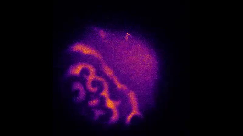 Оплодотворение яйцеклетки