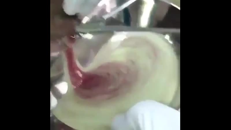 Разрез поднижнечелюстного абсцесса