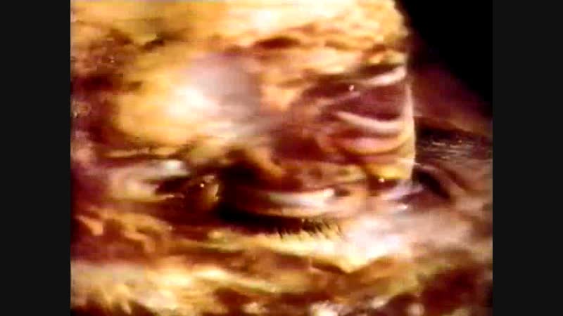 Scorn white irises blind (1993)