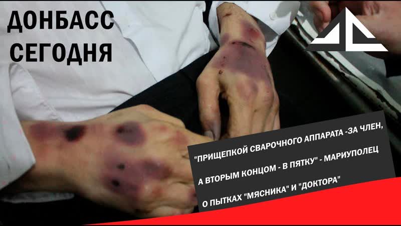 Прищепкой от сварки за член, а вторым концом в пятку мариуполец о пытках