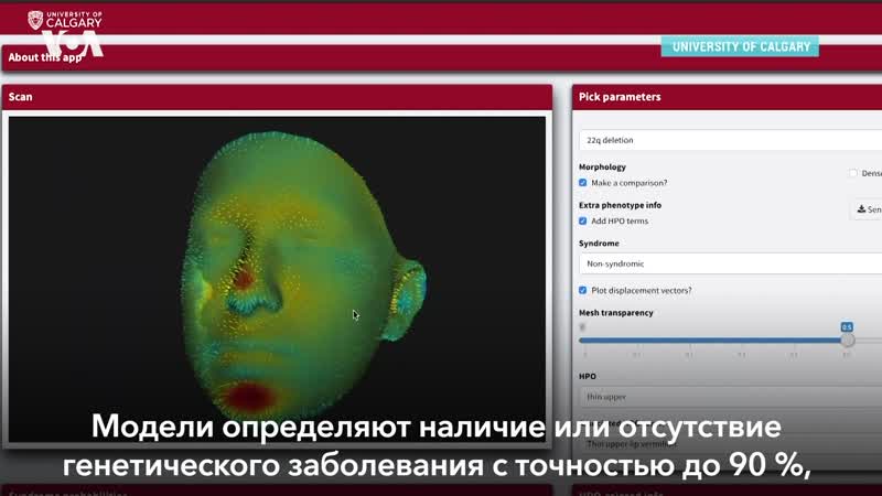 Диагностика заболеваний по лицу