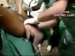 Late term abortion baby stuck inside mother doctor crushes head