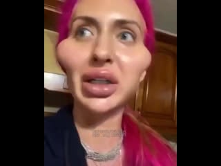 Нашла причину высыпаний 🤣🤣🤒