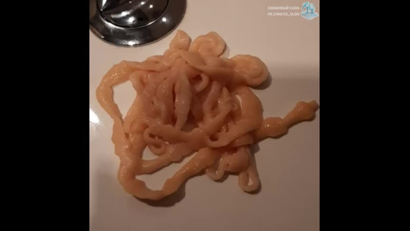 Ленточный червь (cestoda) из кишечника человека