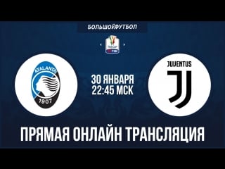 Juve