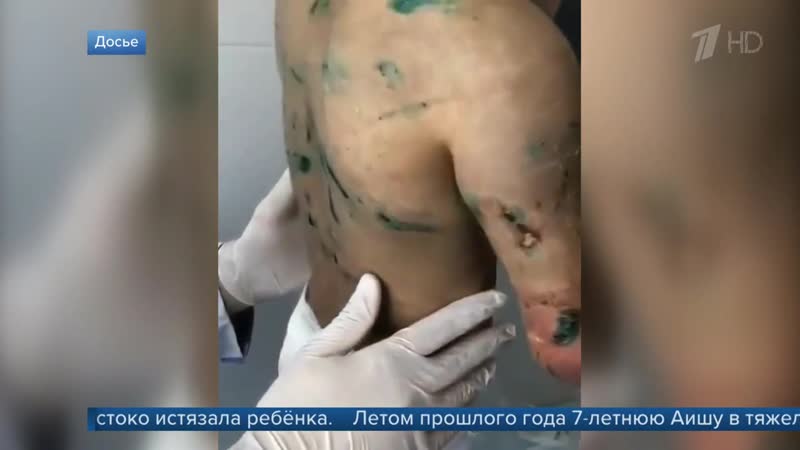 В ингушетии к шести годам колонии суд приговорил женщину, которая жестоко истязала ребенка