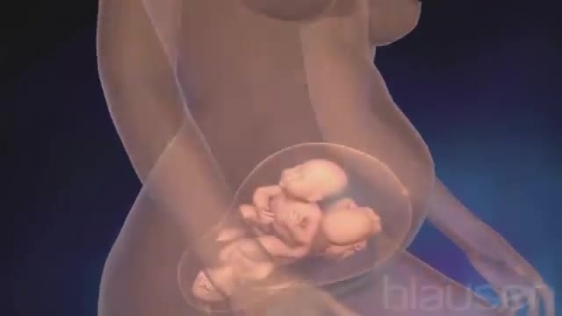 Экстракорпоральное оплодотворение (эко)