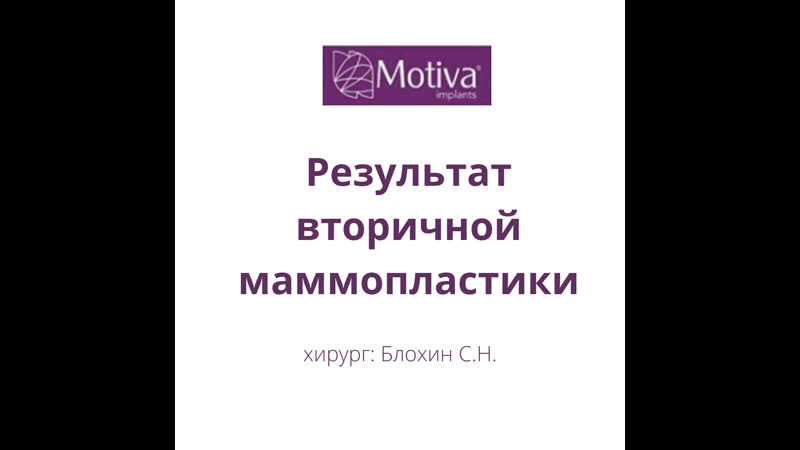 Результат вторичной маммопластики